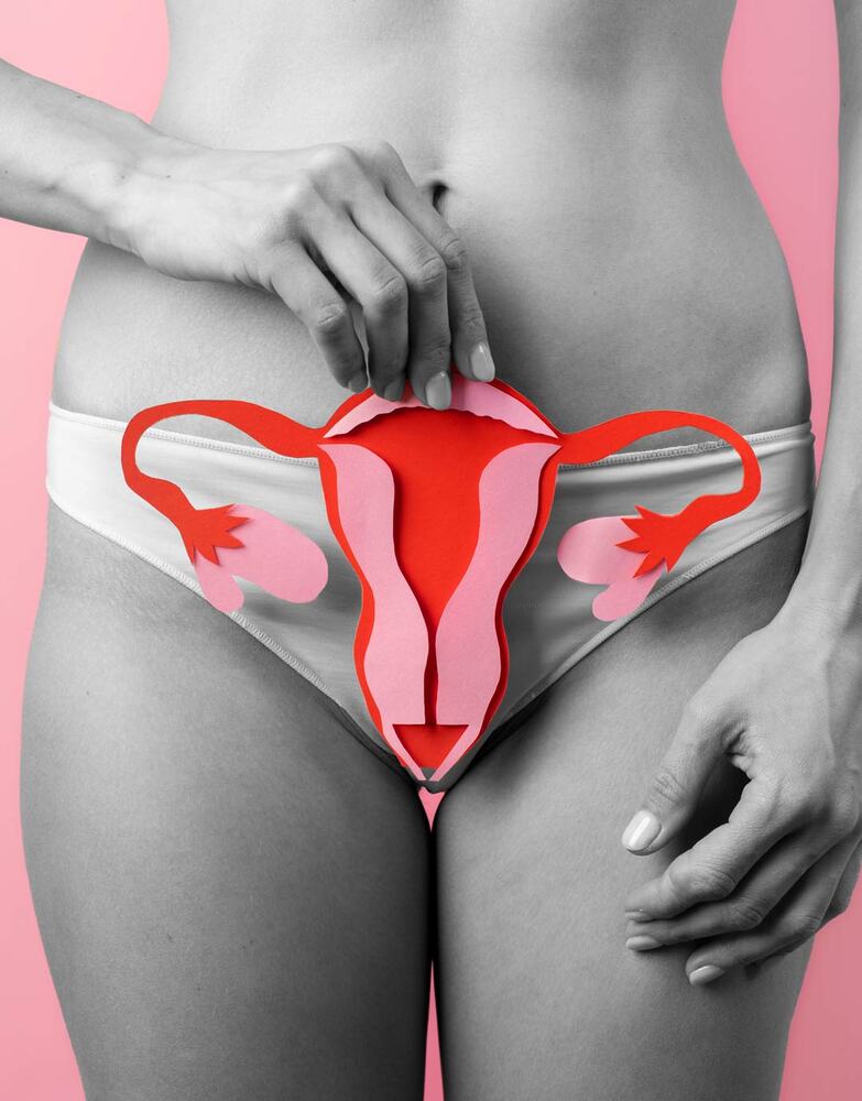Lo que necesitas saber sobre la endometriosis